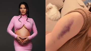 A médica explicou quais são os riscos de acidentes como o de Raissa Barbosa - Reprodução/Instagram