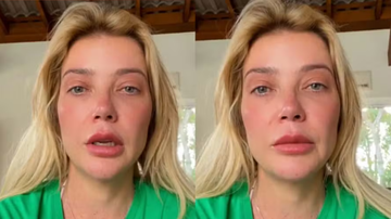 O médico explicou mais detalhes da cirurgia do filho de Luiza Possi - Reprodução/Instagram