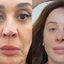 Claudia Raia exibe o antes e o depois