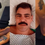 O médico explicou mais detalhes dos hematomas nas pernas de Juliano Cazarré