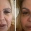 Em 2024, Monique Evans foi diagnosticada com dengue