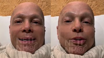 Netinho fala sobre o seu estado de saúde - Foto: Reprodução/Instagram