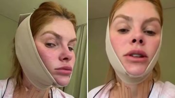 Bárbara Evans vem usando faixas para diminuir a papada - Reprodução/Instagram